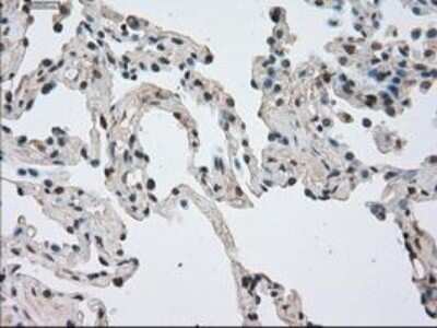 Immunohistochemistry: NEK6 Antibody (OTI5D7) - Azide and BSA Free [NBP2-72938]