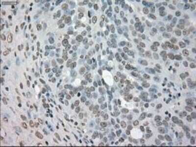 Immunohistochemistry: NEK6 Antibody (OTI5D7) - Azide and BSA Free [NBP2-72938]