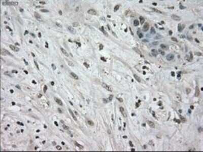 Immunohistochemistry: NEK6 Antibody (OTI5D7) - Azide and BSA Free [NBP2-72938]