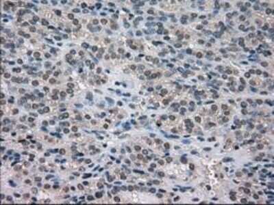 Immunohistochemistry: NEK6 Antibody (OTI5D7) - Azide and BSA Free [NBP2-72938]
