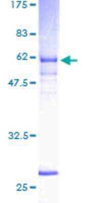SDS-PAGE: Recombinant Human NEK6 GST (N-Term) Protein [H00010783-P01]
