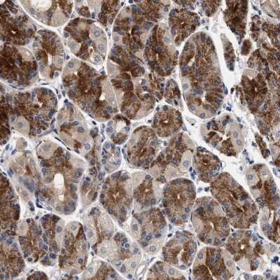 Immunohistochemistry-Paraffin: NEK7 Antibody [NBP1-86444]