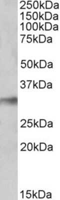 Western Blot: NEK7 Antibody [NBP1-68866]