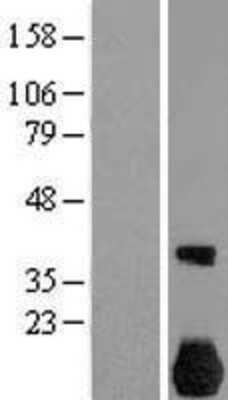 Western Blot: NEK7 Overexpression Lysate [NBL1-13587]