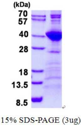 SDS-PAGE: Recombinant Human NEK7 His Protein [NBP2-23287]