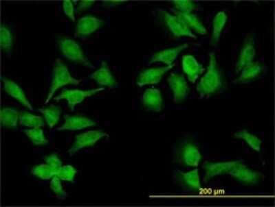 Immunocytochemistry/ Immunofluorescence: NEK9 Antibody (1F6) [H00091754-M01]