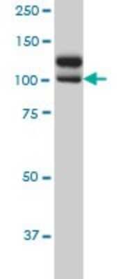 Western Blot: NEK9 Antibody (1F6) [H00091754-M01]