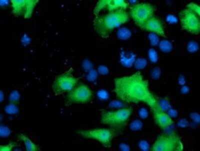 Immunocytochemistry/ Immunofluorescence: NEK9 Antibody (OTI1H1) - Azide and BSA Free [NBP2-72939]
