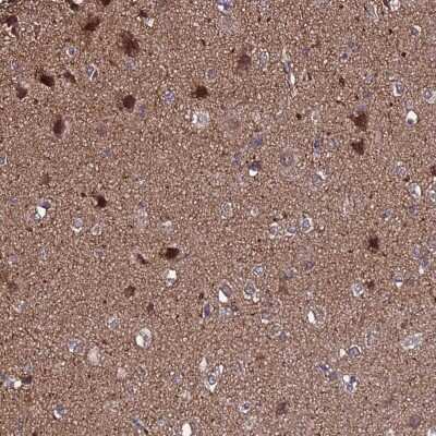 Immunohistochemistry-Paraffin: NELF Antibody [NBP1-92175]