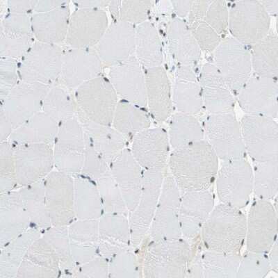 Immunohistochemistry-Paraffin: NELF-E Antibody [NBP1-88036]
