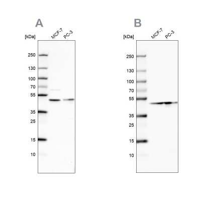 Western Blot: NELF-E Antibody [NBP2-55487]