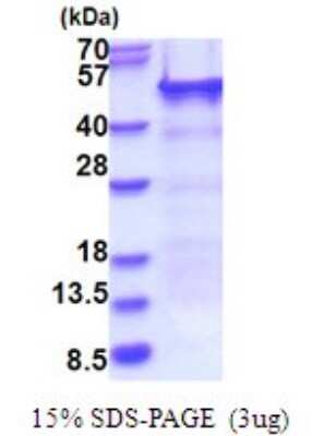 SDS-PAGE: Recombinant Human NELF-E His Protein [NBP2-51698]