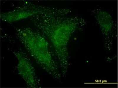 Immunocytochemistry/ Immunofluorescence: NELL1 Antibody (6A8) [H00004745-M01]