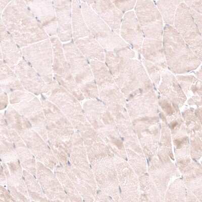 Immunohistochemistry-Paraffin: NELL1 Antibody [NBP2-13651]