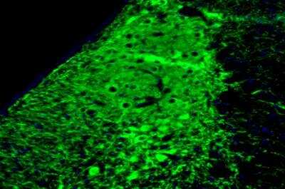 Immunohistochemistry: NET1 Antibody (CL3063) [NBP2-46648]