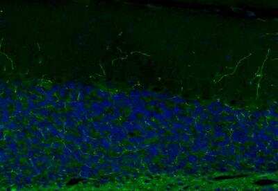 Immunohistochemistry: NET1 Antibody (CL3063) [NBP2-46648]
