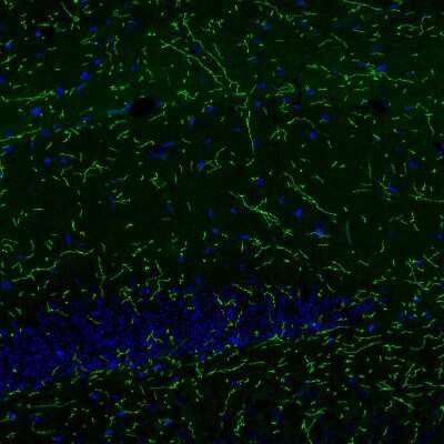 Immunohistochemistry: NET1 Antibody (CL3063) [NBP2-46648]