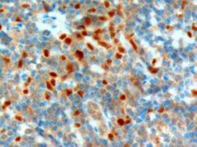 Immunohistochemistry-Paraffin: NET1 Antibody [NB100-1328]