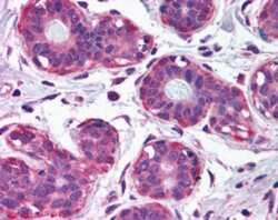 Immunohistochemistry-Paraffin: NET1 Antibody [NB100-40800]