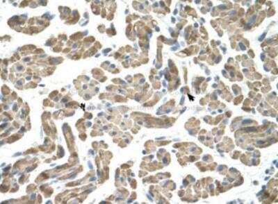 Immunohistochemistry: NEU-1/Sialidase-1 Antibody [NBP1-69387]