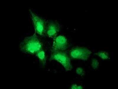 Immunocytochemistry/ Immunofluorescence: NEU2 Antibody (OTI4F4) - Azide and BSA Free [NBP2-72944]