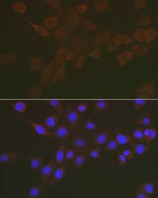 Immunocytochemistry/ Immunofluorescence: NEU3 Antibody - Azide and BSA Free [NBP3-04868]