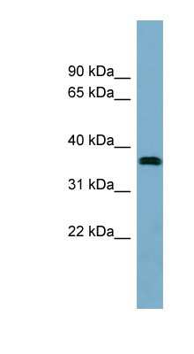 Western Blot: NEURL2 Antibody [NBP1-70651]