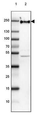 Western Blot: NF-H Antibody (CL2671) [NBP2-46615]