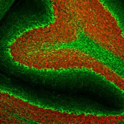 Immunohistochemistry Free-Floating: NF-H Antibody (AH1) [NBP1-05209]