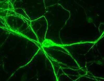 Immunocytochemistry/ Immunofluorescence: NF-H Antibody [NB300-217]