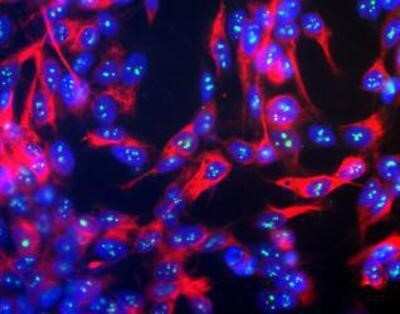 Immunocytochemistry/ Immunofluorescence: NF-H Antibody [NB300-217]