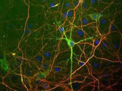Immunocytochemistry/ Immunofluorescence: NF-H Antibody [NB300-217]