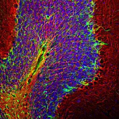 Immunohistochemistry Free-Floating: NF-H Antibody [NB300-217]
