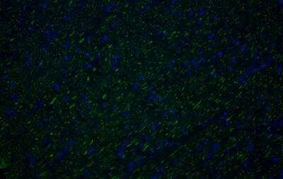 Immunohistochemistry-Frozen: NF-H Antibody [NB300-217]