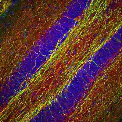 Immunohistochemistry: NF-H Antibody [NB300-135]