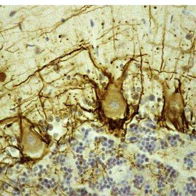 Immunohistochemistry: NF-H Antibody (NAP4) [NB300-136]