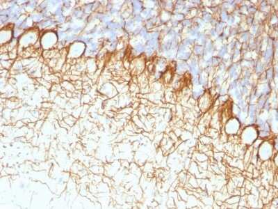 Immunohistochemistry-Paraffin: NF-H Antibody (RT97) [NBP2-29435]