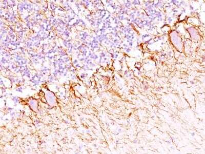 Immunohistochemistry-Paraffin: NF-H Antibody (SPM203) [NBP2-44727]