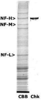 Western Blot: NF-H Antibody [NB300-217]