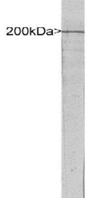 Western Blot: NF-H Antibody [NBP1-05215]