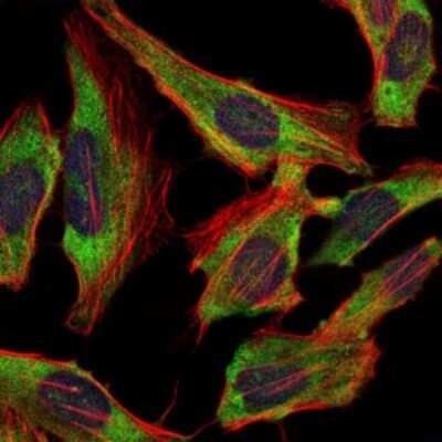 Immunocytochemistry/ Immunofluorescence: NF-L Antibody (2G10) - BSA Free [NBP2-37525]