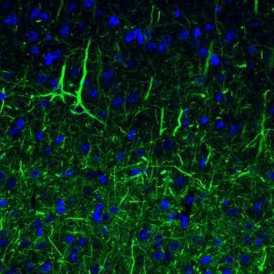 Immunohistochemistry: NF-L Antibody (CL4729) [NBP2-59061]