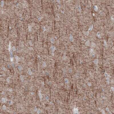 Immunohistochemistry-Paraffin: NF-L Antibody (CL4729) [NBP2-59061]