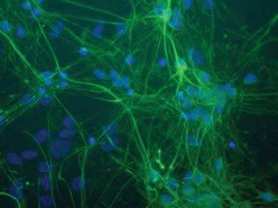 Immunocytochemistry/ Immunofluorescence: NF-L Antibody (DA2) [NB300-132]