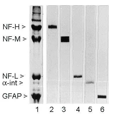 Western Blot: NF-L Antibody (DA2) [NB300-132]