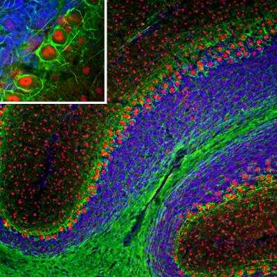 Immunocytochemistry/ Immunofluorescence: NF-L Antibody (7D1) [NBP2-50612]