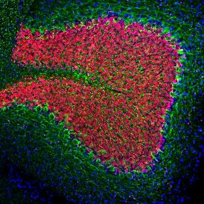 Immunohistochemistry Free-Floating: NF-L Antibody [NBP1-05219]