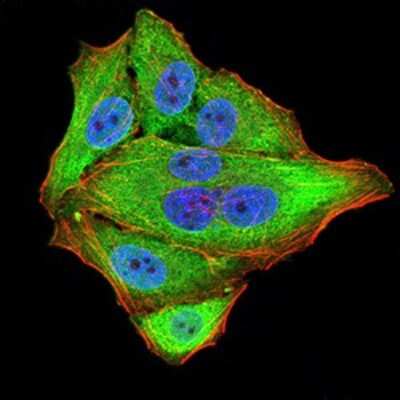 Immunocytochemistry/ Immunofluorescence: NF-M Antibody (1B6B12) - BSA Free [NBP2-61659]