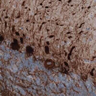 Immunohistochemistry: NF-M Antibody (CL2678) [NBP2-46616]