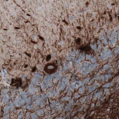 Immunohistochemistry: NF-M Antibody (CL2688) [NBP2-46618]